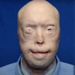 Firefighter suffers third-degree burns – this is him 7 years later
