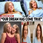 The Conjoined Twins: SURPRISE! We’ve Been Separated!
