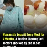 Woman Ate Eggs at Every Meal for Five Months—A Routine Checkup Revealed a Surprising Blood Test Result