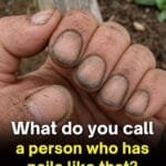 What Dirty Fingernails Really Reveal