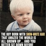 The Boy With Snow-White Hair Who Captivated the World – Where Is He Now?