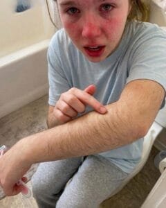 Teen Girls First Boyfriend Made Her Cry over Her Arm Hair Instead of Getting Angry Her Father Invited Him to Dinner