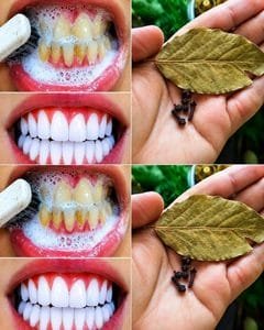 Whiten your teeth and remove tartar in just 2 minutes with cloves and bay leaves
