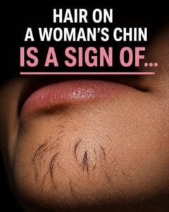 Why Chin Hair Grows in Women and What It M